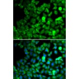 Immunofluorescence - SARS antibody from Signalway Antibody (39139) - Antibodies.com