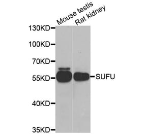 Western blot - SUFU antibody from Signalway Antibody (39155) - Antibodies.com