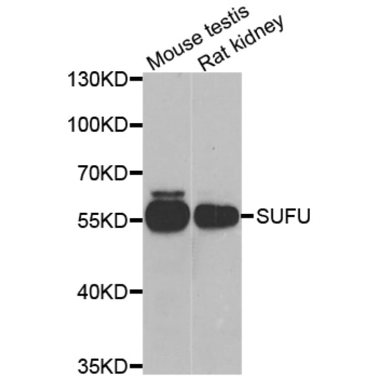 Western blot - SUFU antibody from Signalway Antibody (39155) - Antibodies.com