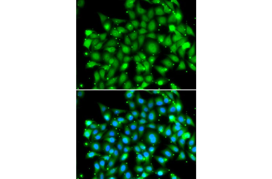Immunofluorescence - SUFU antibody from Signalway Antibody (39155) - Antibodies.com
