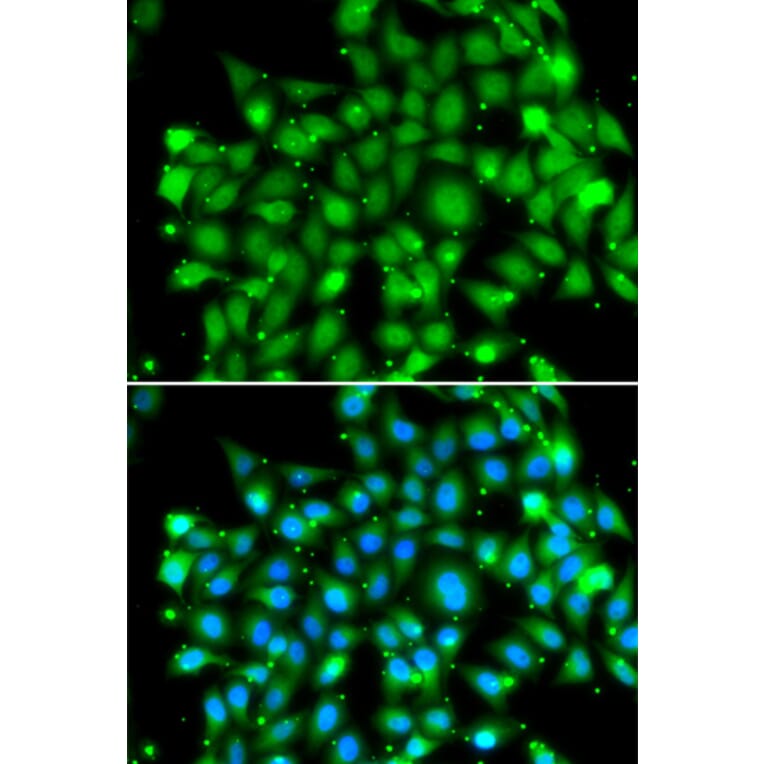 Immunofluorescence - SUFU antibody from Signalway Antibody (39155) - Antibodies.com