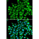 Immunofluorescence - SUFU antibody from Signalway Antibody (39155) - Antibodies.com