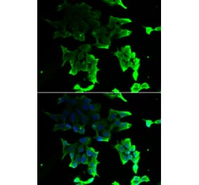 Immunofluorescence - TANK antibody from Signalway Antibody (39161) - Antibodies.com