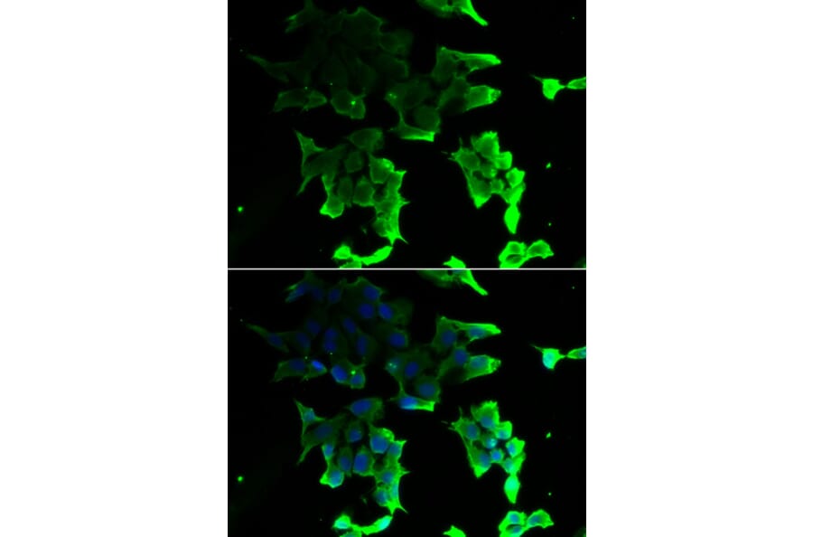 Immunofluorescence - TANK antibody from Signalway Antibody (39161) - Antibodies.com