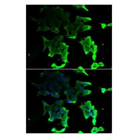 Immunofluorescence - TANK antibody from Signalway Antibody (39161) - Antibodies.com