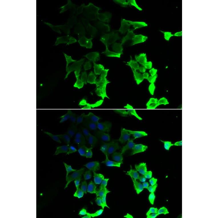 Immunofluorescence - TANK antibody from Signalway Antibody (39161) - Antibodies.com