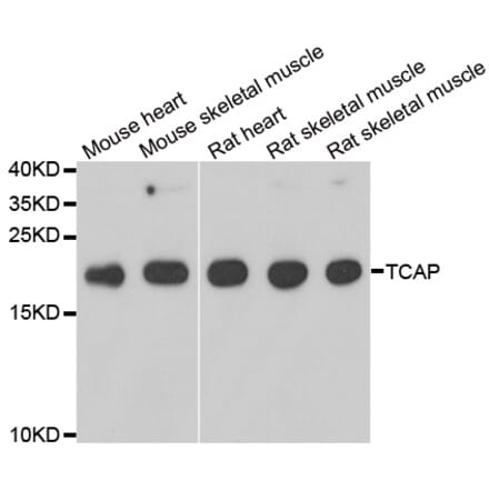 Western blot - TCAP antibody from Signalway Antibody (39163) - Antibodies.com