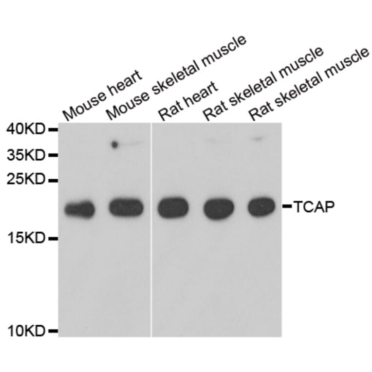 Western blot - TCAP antibody from Signalway Antibody (39163) - Antibodies.com