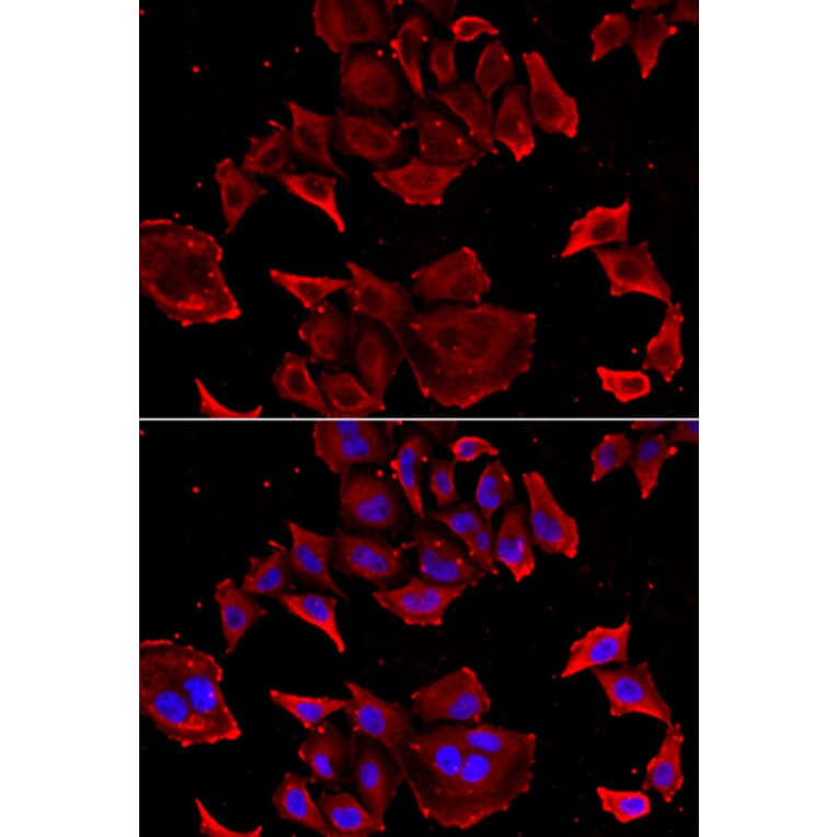 Immunofluorescence - TCAP antibody from Signalway Antibody (39163) - Antibodies.com
