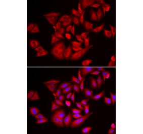 Immunofluorescence - TLK2 antibody from Signalway Antibody (39166) - Antibodies.com