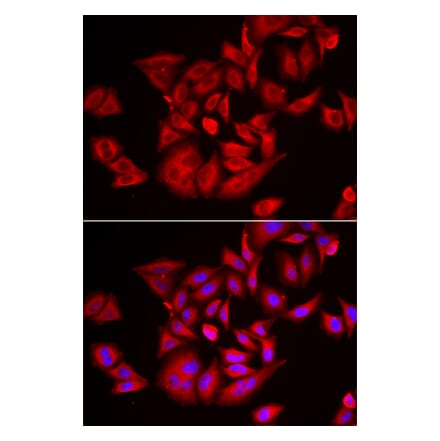 Immunofluorescence - TLK2 antibody from Signalway Antibody (39166) - Antibodies.com