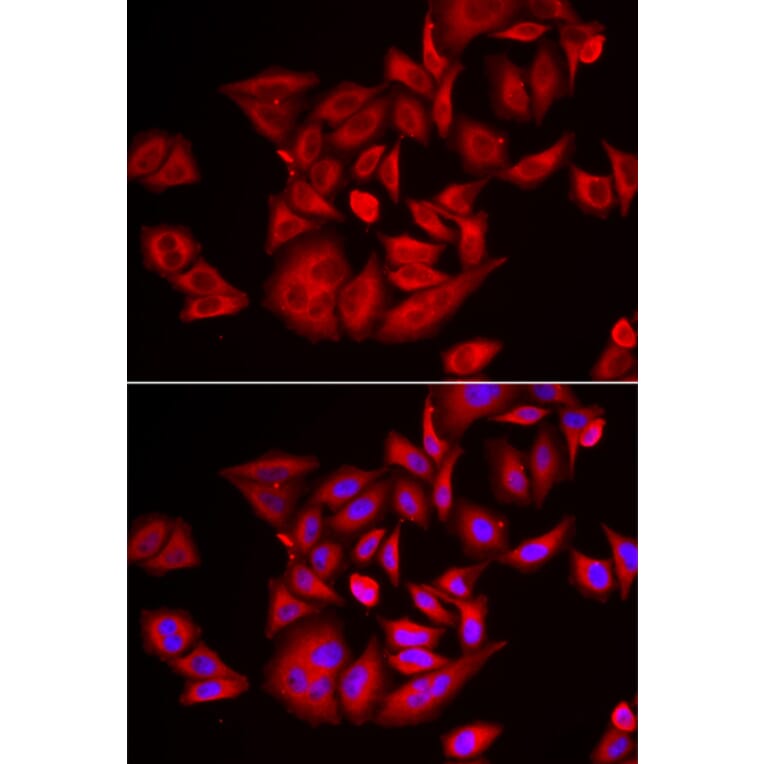 Immunofluorescence - TLK2 antibody from Signalway Antibody (39166) - Antibodies.com