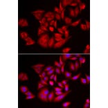 Immunofluorescence - TLK2 antibody from Signalway Antibody (39166) - Antibodies.com