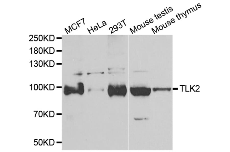 Western blot - TLK2 antibody from Signalway Antibody (39166) - Antibodies.com