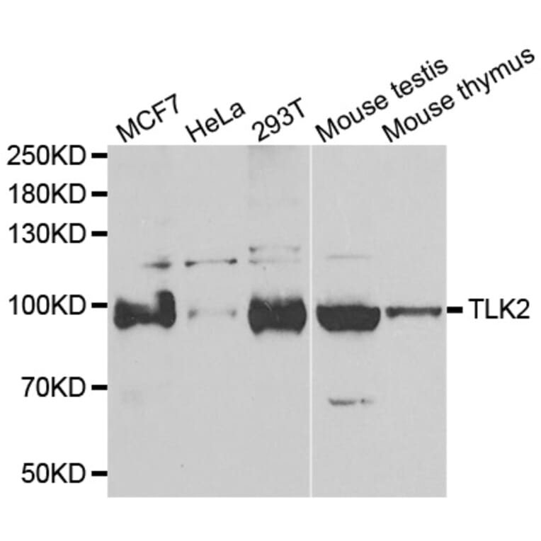 Western blot - TLK2 antibody from Signalway Antibody (39166) - Antibodies.com