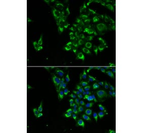 Immunofluorescence - TSHB antibody from Signalway Antibody (39176) - Antibodies.com