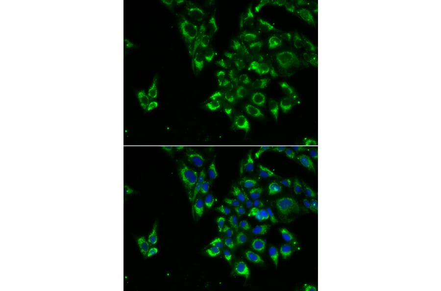 Immunofluorescence - TSHB antibody from Signalway Antibody (39176) - Antibodies.com