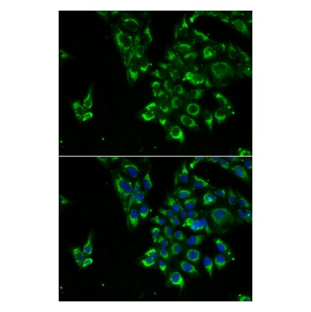 Immunofluorescence - TSHB antibody from Signalway Antibody (39176) - Antibodies.com