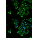 Immunofluorescence - TSHB antibody from Signalway Antibody (39176) - Antibodies.com