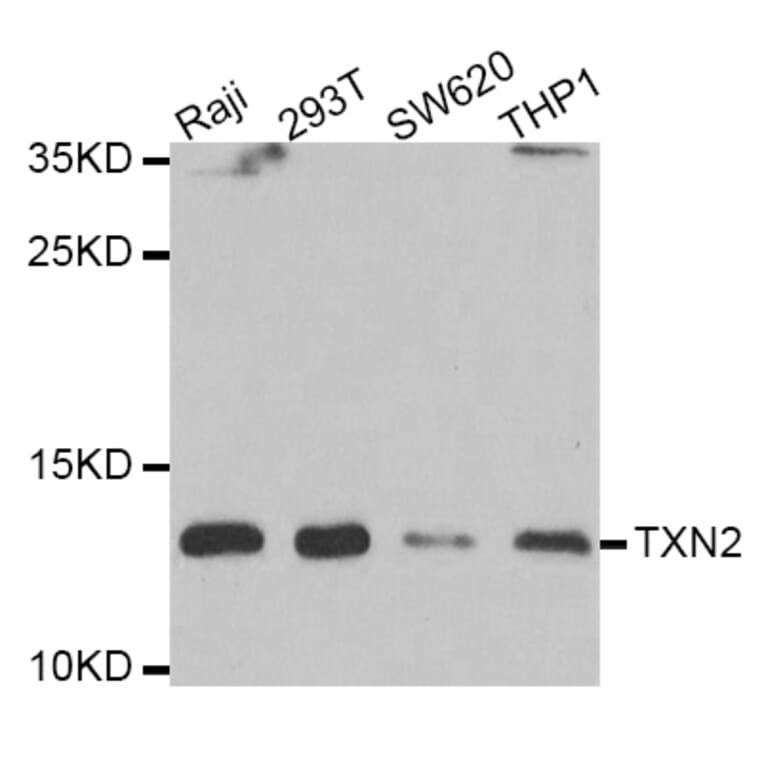 Western blot - TXN2 antibody from Signalway Antibody (39178) - Antibodies.com