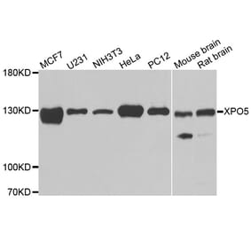 Western blot - XPO5 antibody from Signalway Antibody (39182) - Antibodies.com