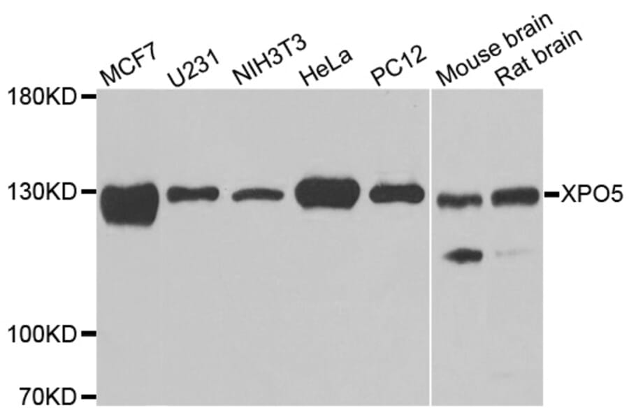 Western blot - XPO5 antibody from Signalway Antibody (39182) - Antibodies.com