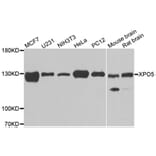 Western blot - XPO5 antibody from Signalway Antibody (39182) - Antibodies.com