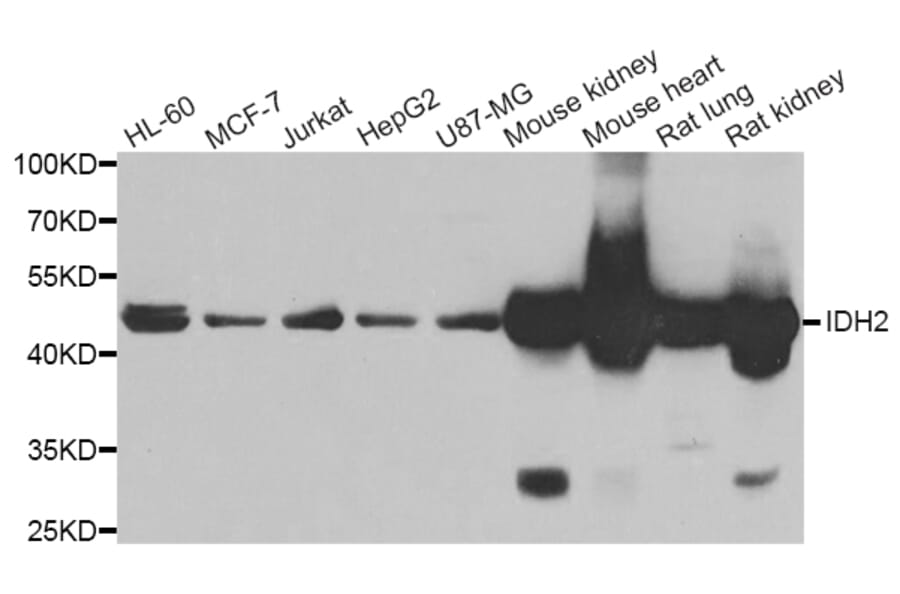Western blot - IDH2 antibody from Signalway Antibody (39188) - Antibodies.com