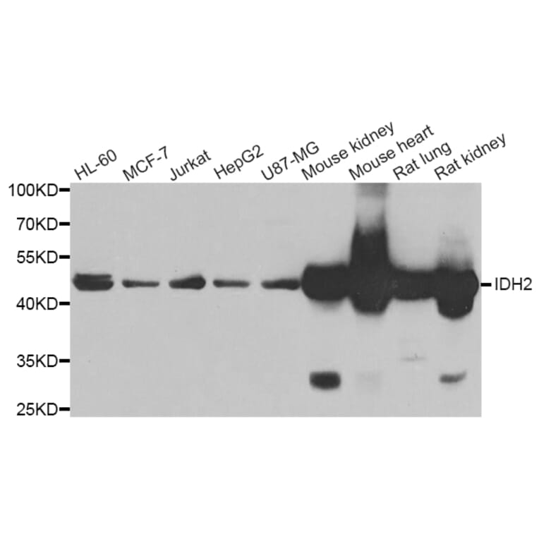 Western blot - IDH2 antibody from Signalway Antibody (39188) - Antibodies.com