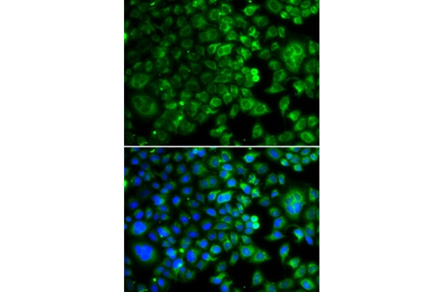 Immunofluorescence - IDH2 antibody from Signalway Antibody (39188) - Antibodies.com