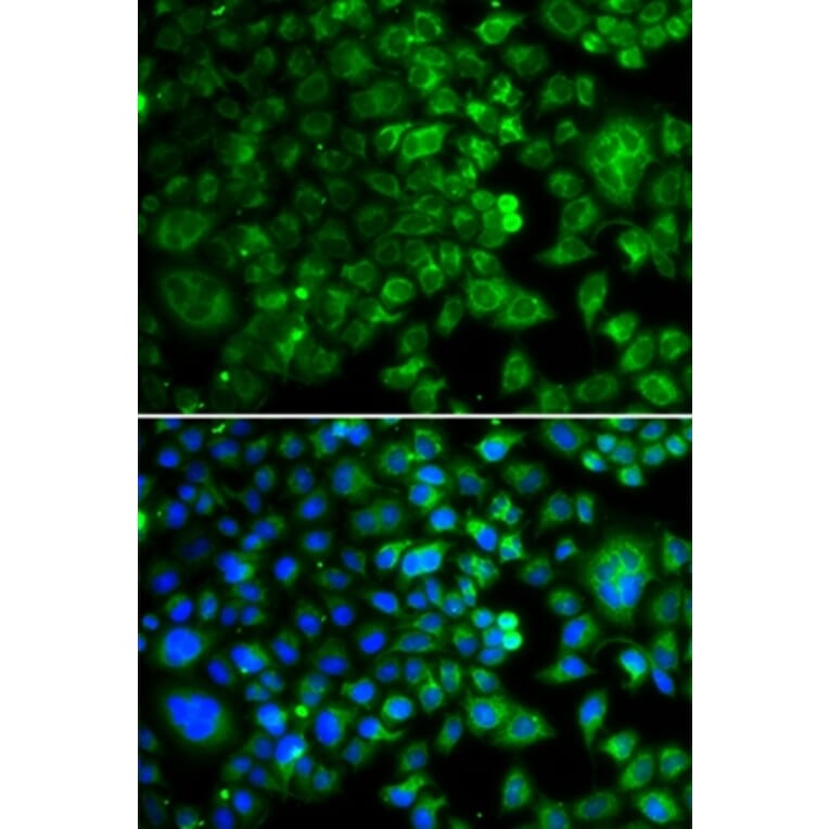 Immunofluorescence - IDH2 antibody from Signalway Antibody (39188) - Antibodies.com