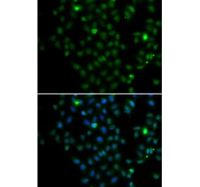 Immunofluorescence - LMO4 antibody from Signalway Antibody (39194) - Antibodies.com