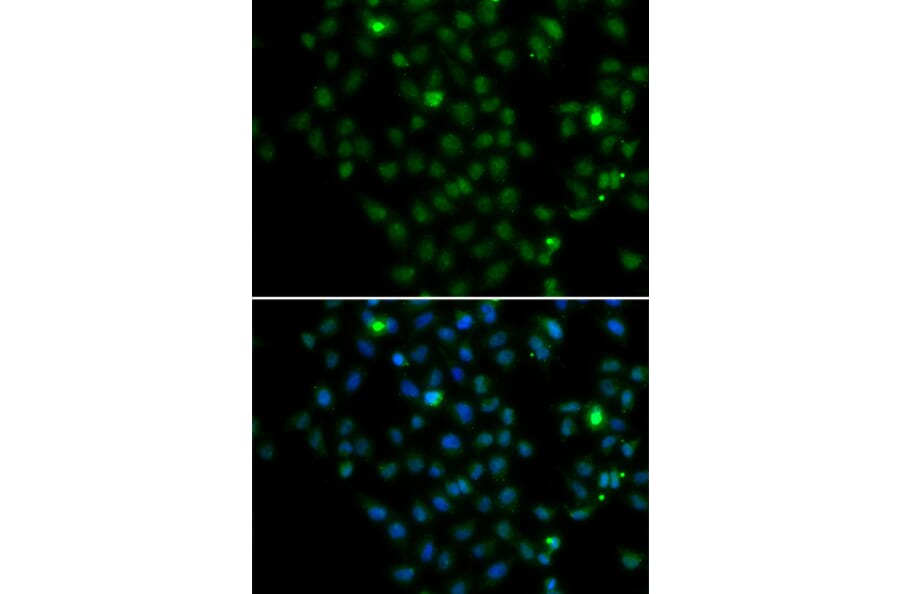 Immunofluorescence - LMO4 antibody from Signalway Antibody (39194) - Antibodies.com