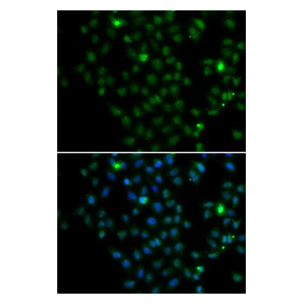Immunofluorescence - LMO4 antibody from Signalway Antibody (39194) - Antibodies.com