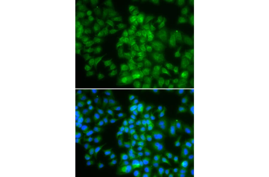 Immunofluorescence - LMO4 antibody from Signalway Antibody (39194) - Antibodies.com