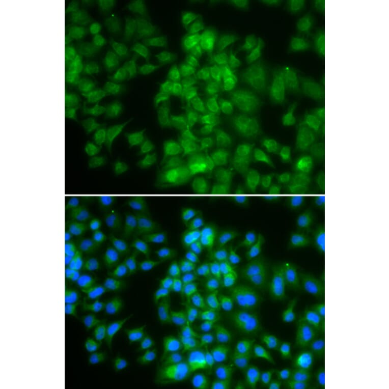 Immunofluorescence - LMO4 antibody from Signalway Antibody (39194) - Antibodies.com