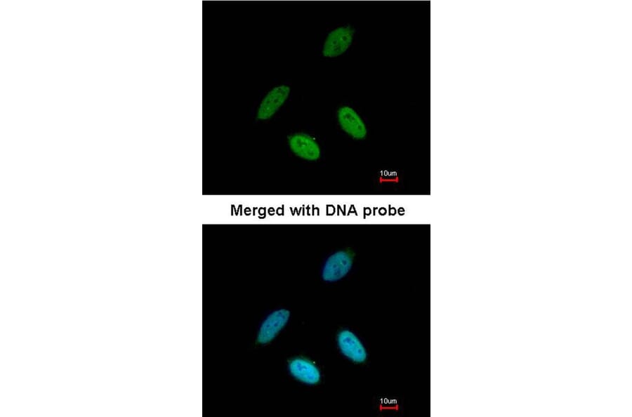 Immunofluorescence - TAP antibody from Signalway Antibody (22138) - Antibodies.com