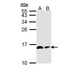 ACP antibody from Signalway Antibody (22344) - Antibodies.com