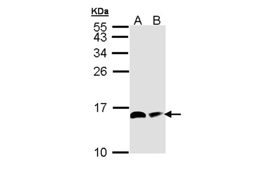 ACP antibody from Signalway Antibody (22344) - Antibodies.com