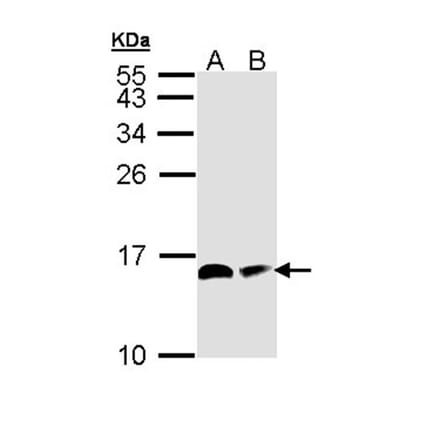 ACP antibody from Signalway Antibody (22344) - Antibodies.com