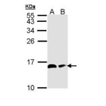 ACP antibody from Signalway Antibody (22344) - Antibodies.com