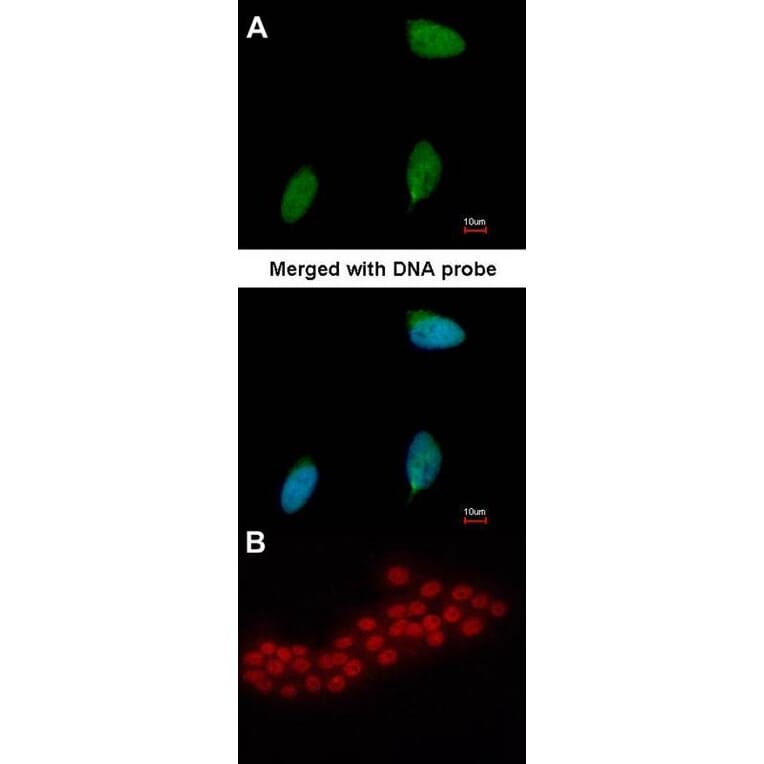 Immunofluorescence - ERG antibody from Signalway Antibody (22577) - Antibodies.com