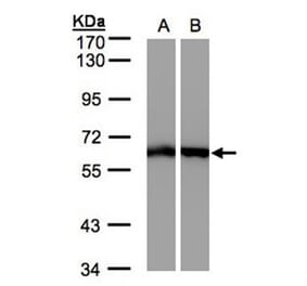 ME1 antibody from Signalway Antibody (22785) - Antibodies.com