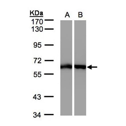 ME1 antibody from Signalway Antibody (22785) - Antibodies.com