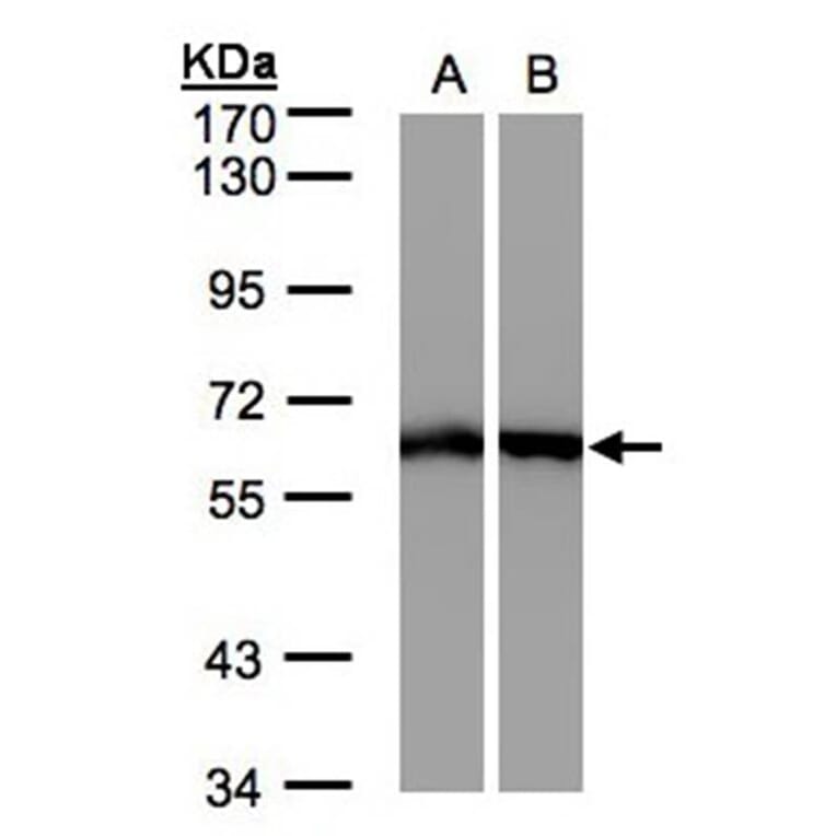 ME1 antibody from Signalway Antibody (22785) - Antibodies.com