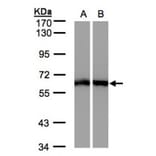 ME1 antibody from Signalway Antibody (22785) - Antibodies.com