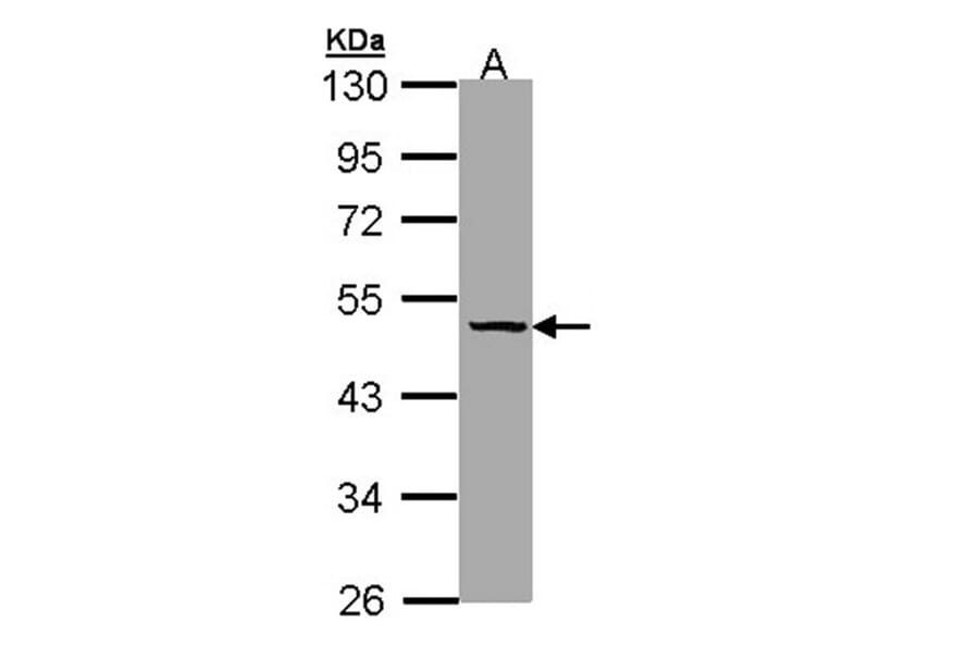 TBG antibody from Signalway Antibody (22946) - Antibodies.com