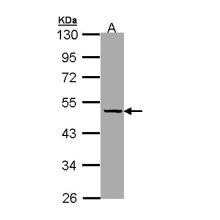 TBG antibody from Signalway Antibody (22946) - Antibodies.com