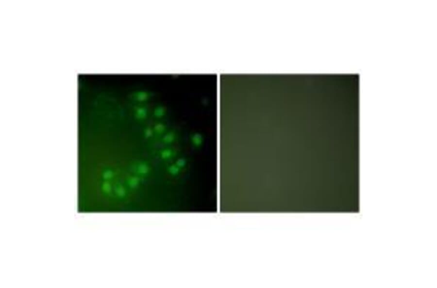 Immunofluorescence - p63 Antibody from Signalway Antibody (33462) - Antibodies.com