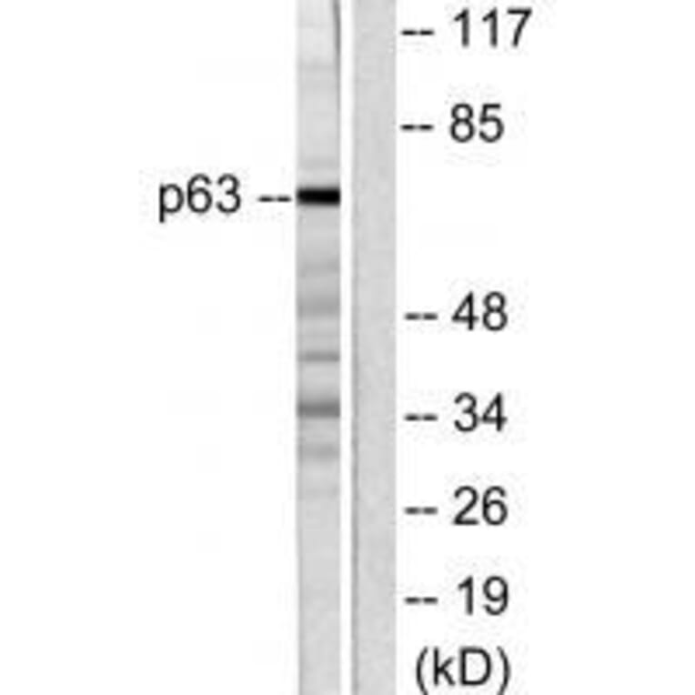 Western blot - p63 Antibody from Signalway Antibody (33462) - Antibodies.com